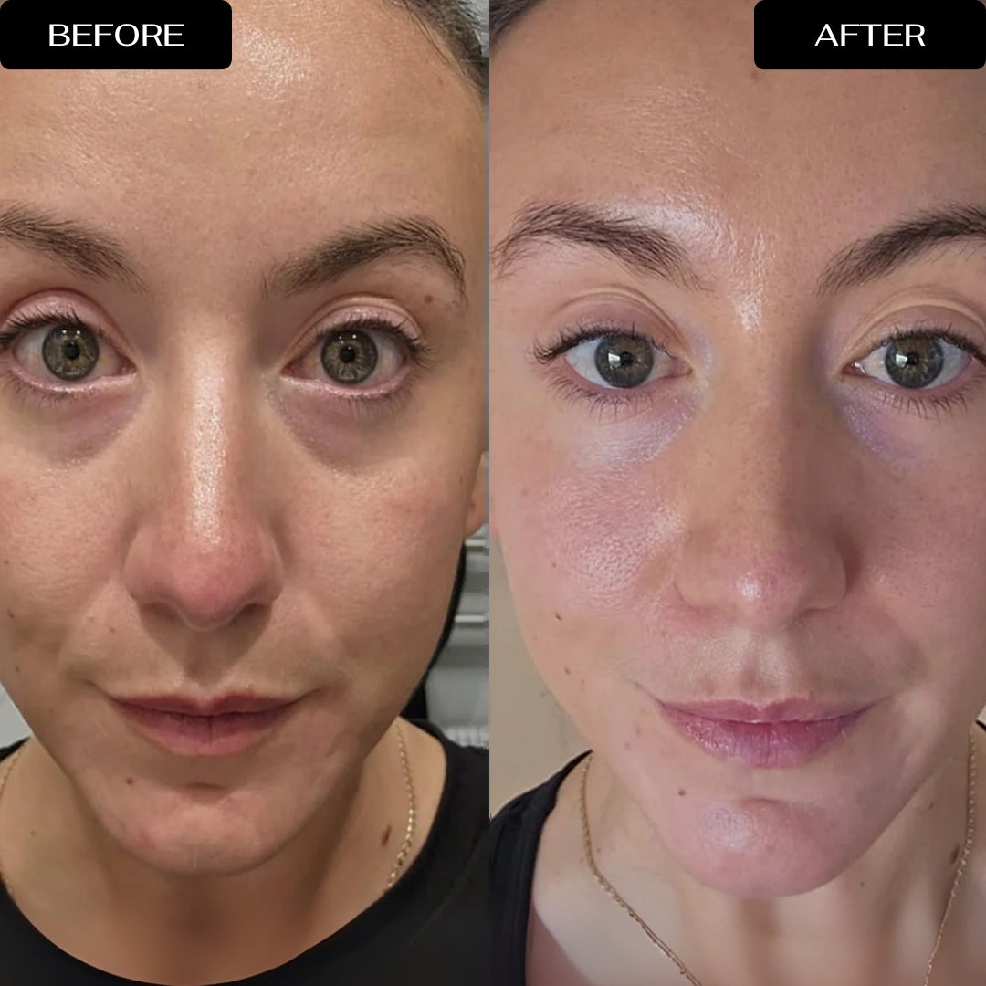 4D Eye Renewal Complex