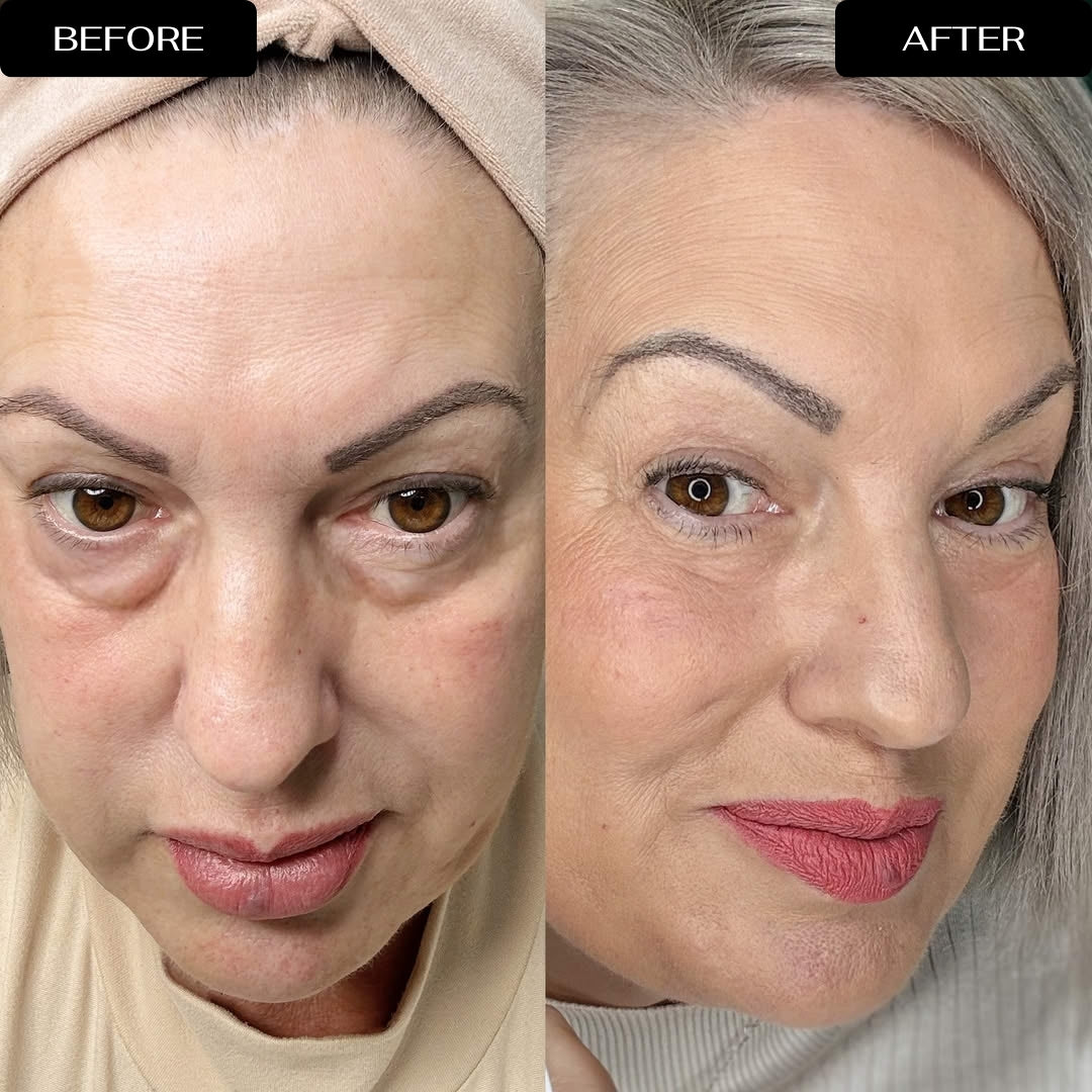 4D Eye Renewal Complex